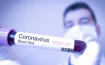 U Srbiji 3.497 novozaraženih koronavirusom, preminulo 15 osoba