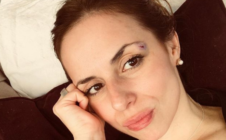 Ana iz Beograda, koja je nestala u SAD-u: Objavljivala sliku sa posjekotinom iznad oka, pa mijenjala opis