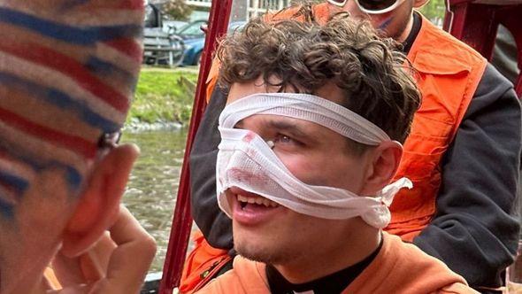Lando Noris doživio povredu lica na zabavi u Amsterdamu